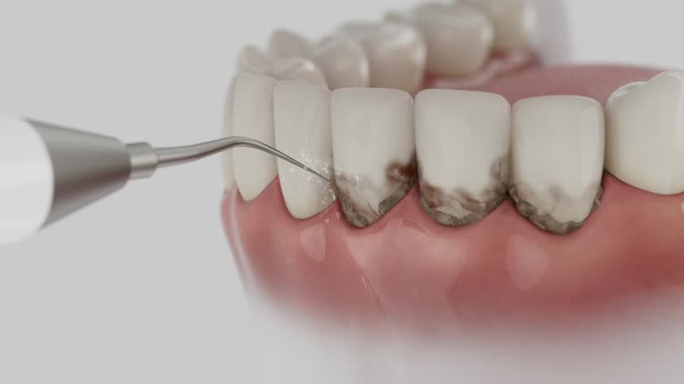 Trusted Emergency Dentist service in Palm Valley, TX - Dentist Open Now